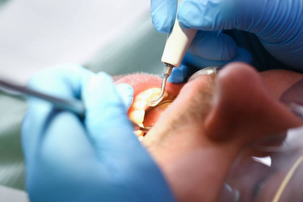 Best Emergency Orthodontic Repairs in Aviston, IL