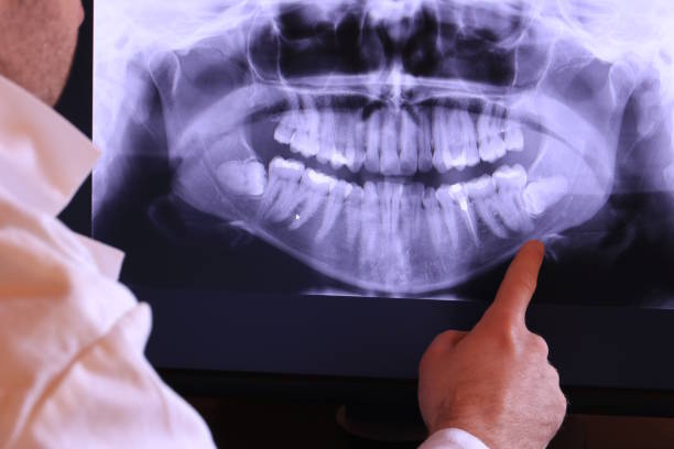 Best Emergency Treatment for Toothache in Aviston, IL