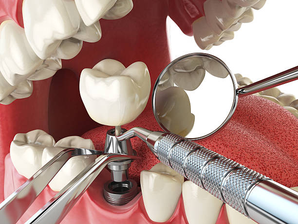 Best Emergency Dental Care for Trauma or Injury in Aviston, IL